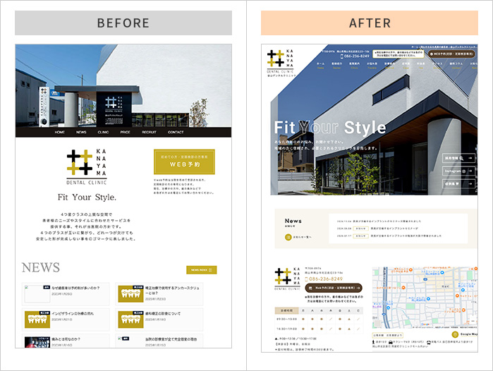 マウスピース矯正